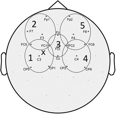 Intracortical Inhibition and Surround Inhibition in the Motor Cortex: A TMS-EEG Study